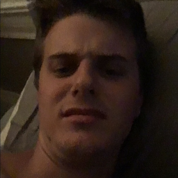 Multiple chins - Picture 1 of 1